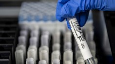 COVID-19 potvrdili aj pracovníčke domova dôchodcov v Seredi