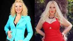 Schudla 44 kíl a zničila si zdravie. Dnes je kyprá a robí modelku