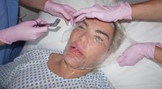 Brazílsky Ken má ťažké srdce na Česko. Vraj ho tam zohyzdili