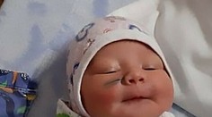 Zhrozená matka zostala po pôrode v šoku: Bábätko malo na líci škaredú jazvu