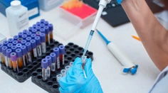 Prelomový liek na HIV je objavom minulého roka. Vírus však stále nedokáže vyliečiť