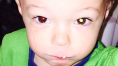 Táto fotka zachránila chlapčekovi život. Čo je na nej iné?