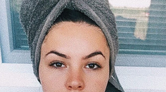 Exfarmárka Lula si nechala napichať pery. Ukázala výsledok