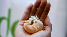 Sú Slováci za sprísnenie pravidiel potratov? Na telo prináša exkluzívny prieskum