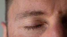 Sociálnymi sieťami sa šíri bizarný trend. Muži si skracujú alebo holia mihalnice