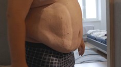 Novodobé lieky na chudnutie priniesli prevrat. Expert sa obáva, že sa začnú predpisovať vo veľkom