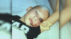 Liečba syna ju stála množstvo peňazí, polícia nehodu za takmer dva roky stále nevyšetrila