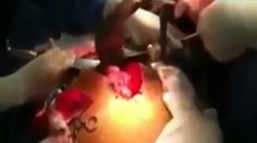 Mužovi vytiahli z brucha polmetrové ryby