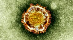 Šesť filipínskych zdravotníkov sa nakazilo koronavírusom MERS, jeden zomrel