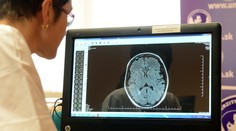 Na Záhorí nemajú neurológa a situácia je už neúnosná. Pacientku Ingrid nechcú objednať ani v inom okrese
