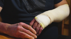 Pred ohňom sa nepodarilo zachrániť takmer nič. Ťažko popálený farmár nás prijal na svojom gazdovstve