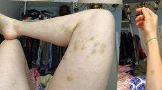 Známa komička odhalila ničivé tajomstvo. S tyranom žila niekoľko mesiacov