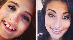 Geniálne video vám ukáže, ako strojček zmení vaše zuby