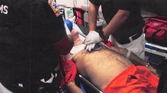 Epsteinova smrť vyvoláva znepokojujúce otázky. Bolo to skôr uškrtenie ako vražda, tvrdí patológ, ktorý bol pri pitve