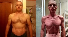 Košičan pil 35 dní iba vodu a takto dopadol