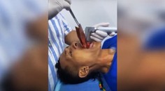 VIDEO: Rybár si chcel v ústach zachytiť rybu. Po tom, ako mu skĺzla do hrdla, skončil v nemocnici