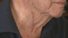 Na operačnej sále zažil minúty hrôzy: Operovali ho bez toho, aby mu zaúčinkovala anestéza