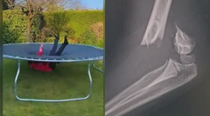 Najväčší strašiak pre rodičov je obľúbená letná atrakcia. Lekár v Prešove varuje, čo sa môže stať