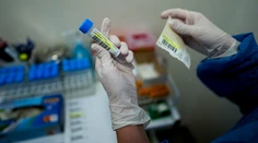 Každý desiaty PCR test na Slovensku mal v sobotu pozitívny výsledok