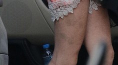 Nohy stareny? Kdeže, ich majiteľkou je mladá herečka