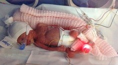 Novorodeniatko bolo veľké ako matkina dlaň. Dnes je z nej krásne dievčatko