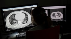 Desiatky zamestnancov nemocnice v Ružomberku sú v izolácii, prišli do styku s nakazeným pacientom