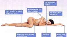 7 šokujúcich fyzických príznakov toho, že ste v strese