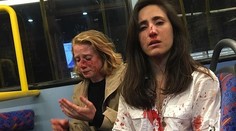 Nechceli si dať na povel v autobuse pusu, tak ich dobili päsťami. Útočníci mali iba do 18 rokov