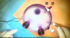 Lekári z celého sveta sa od tých slovenských učia, ako sa operuje cez "jednu dierku"