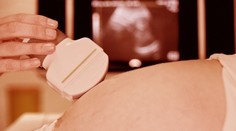 Starostlivosť o tehotné ženy je u nás špičková, hovorí odborník. Garancia dokonalého pôrodu však nie je a nikdy nebude