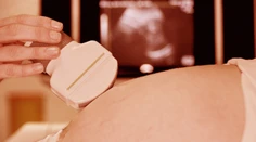 Starostlivosť o tehotné ženy je u nás špičková, hovorí odborník. Garancia dokonalého pôrodu však nie je a nikdy nebude