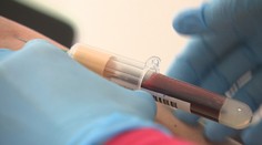 Niektorých ľudí v piatok zaskočila SMS od lekárskej fakulty. Vybrali si ich na významný výskum