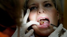 Zubári nesmú od júla používať amalgámové plomby pri týchto pacientoch