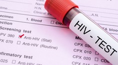 V Česku sa zvýšil počet nositeľov vírusu HIV, polícia vyšetruje zámerné šírenie