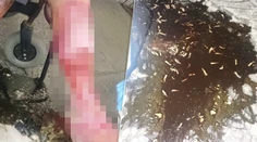 FOTO: Slovenský lekár riešil šokujúci prípad. Muž mal v nohe toľko živých červov, že sa nedali spočítať