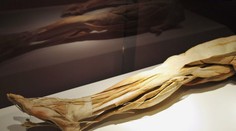 KDH žiada zrušiť výstavu skutočných ľudských tiel v Bratislave