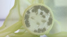 Desiatky ľudí sa v Košiciach sa nakazili encefalitídou, pôvodca zostáva neznámy