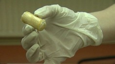 Dievčatku našli v žalúdku 104 kapsúl s neznámou drogou