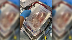 Z Košíc do Prahy prvýkrát transportovali bijúce srdce. Jeden muž po smrti zachráni život druhému