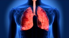 Na Slovákov zaútočili pľúcne chlamýdie. Mnohí o tom netušia