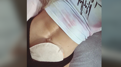 Mladé dievča trpí vážnou chorobou. Šíri osvetu o živote s vývodom