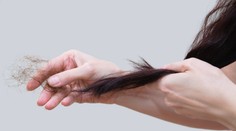 Niektorým ľuďom pre covid vypadávajú vlasy. Lekár radí, čo s tým robiť