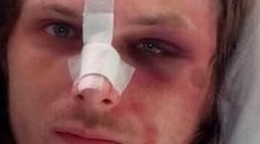 Takto vyzerá Štefan po policajnom zásahu. Vraj kládol odpor