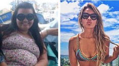 Z bacuľky modelkou! Po schudnutí však zostala Thayne zjazvená koža