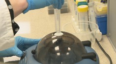 Športovkyne zrejme podstúpia test, ktorý má dokázať, že nemajú mužské gény. Týkať sa to má aj slovenskej hviezdy