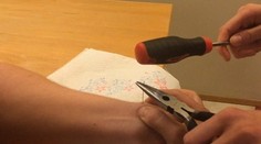 Muž si pichol ihlu do cysty. Toto z nej vytieklo