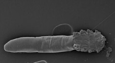 Tento parazit žije vo vašej tvári. Nezmyjete ho ani vodou