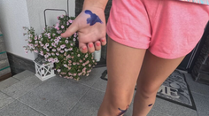 Pes, ktorý napadol dievčatko (8) v obci Sverepec a spôsobil jej veľmi nepríjemné zranenia, neútočil prvýkrát