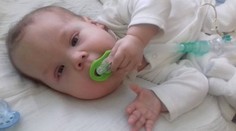 Majko prišiel na svet s telíčkom plným nádorov. Čaká ho ešte náročná cesta