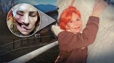 Slovenku trápi záhadný parazit, ktorý jej požiera tvár zaživa. Rodina je bezradná, lekári jej nevedia pomôcť